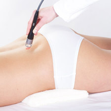 Laser therapy appllication. Low back pain.