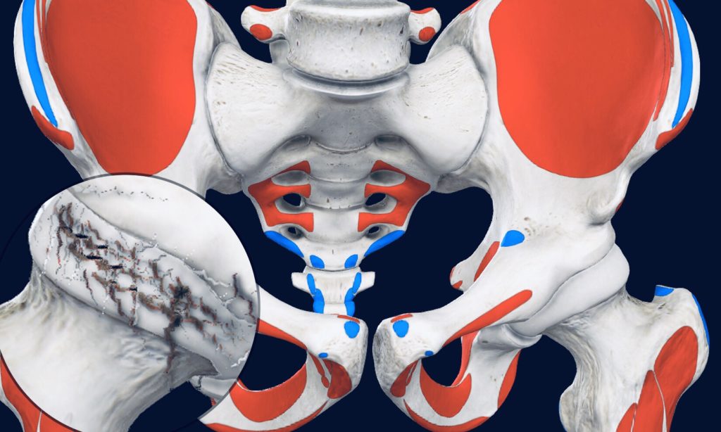 Article. Osteoarthrosis.