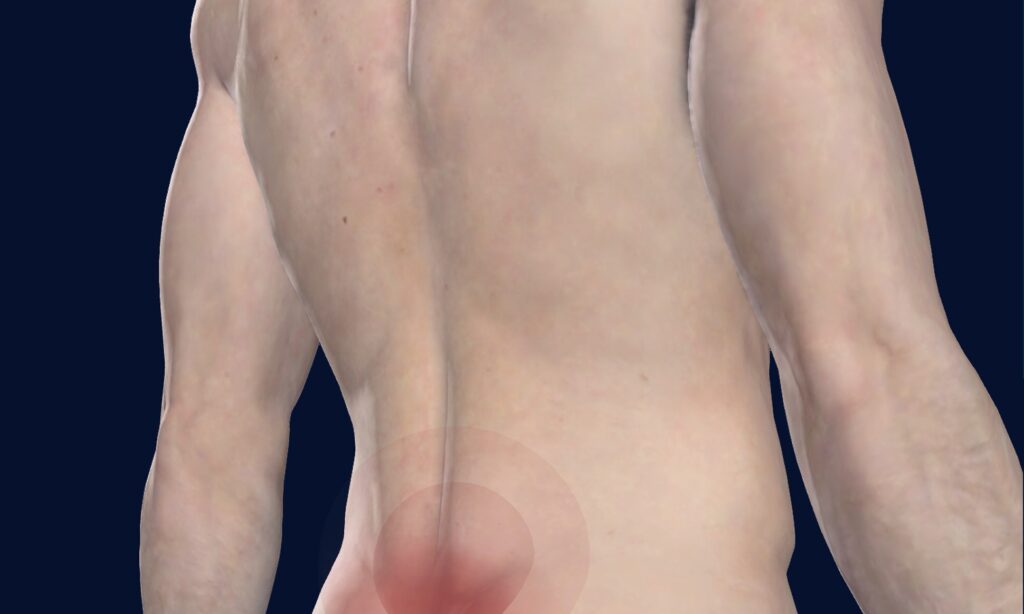 When should you be worried about lower back pain?