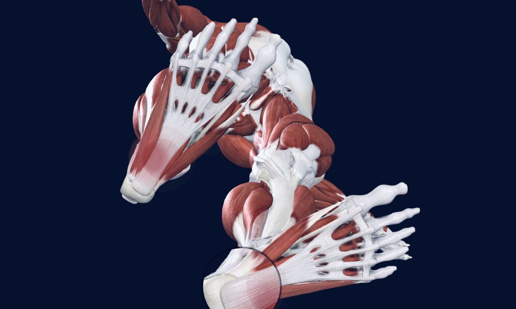 Plantar fasciitis (say "PLAN-ter fash-ee-EYE-tus") is the most common cause of heel pain.