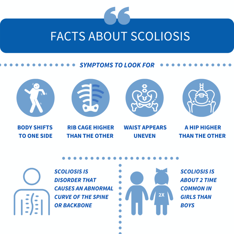 Scoliosis Causes, Symptoms & Treatment Osteo Health osteopath