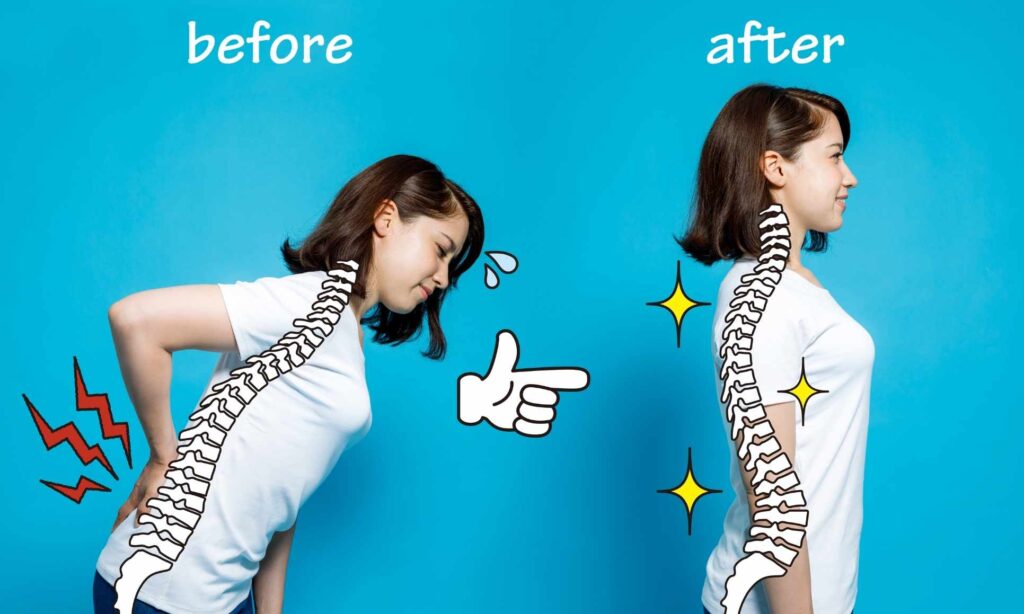 Scoliosis treatment at the Osteo Health Clinic