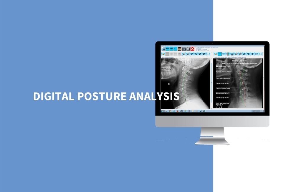 posture assessment