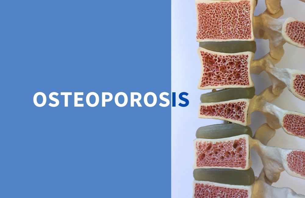 Osteoporosis