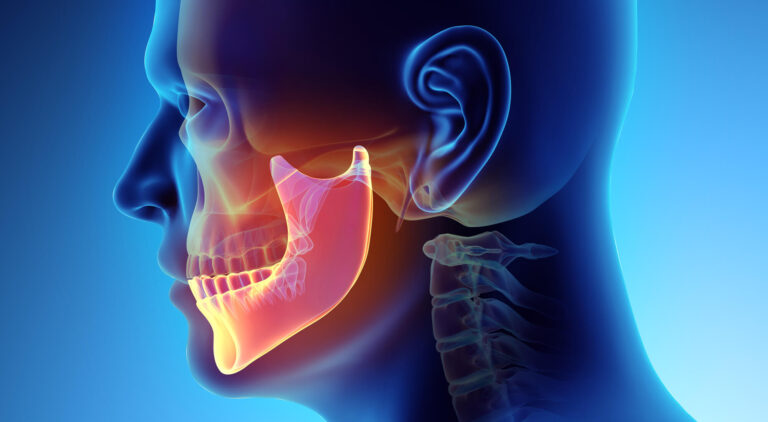 tmd treatment