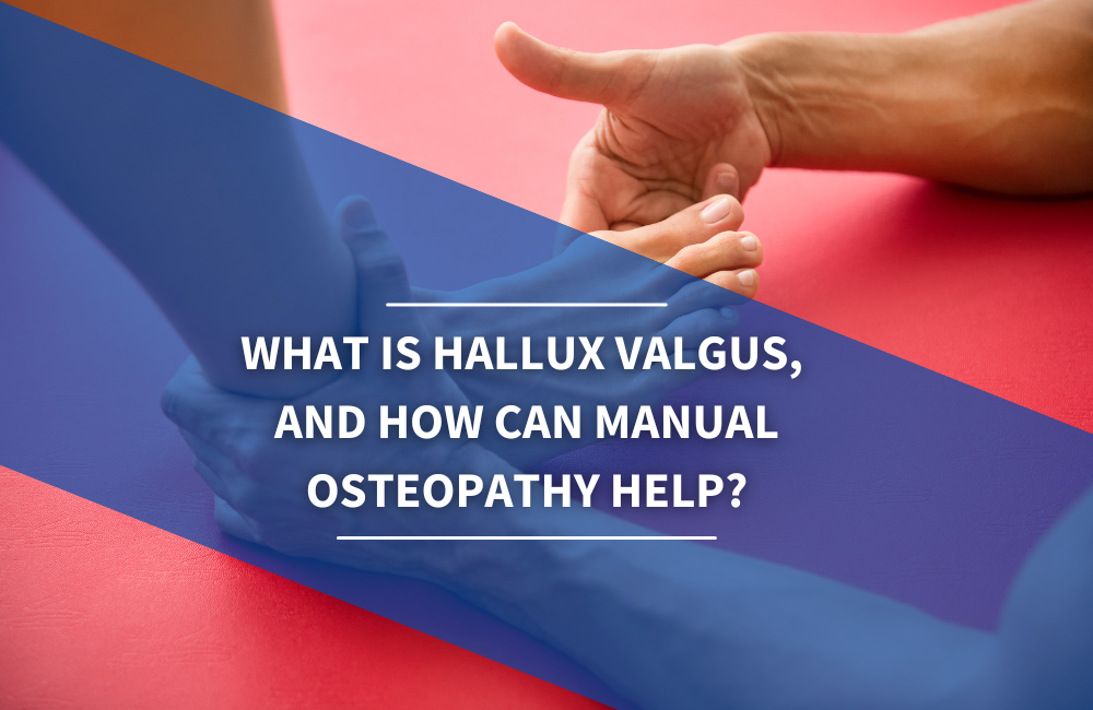 What is hallux valgus, and how can manual osteopathy help? Osteo