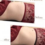 Lymphatic Drainage Osteo Health Calgary