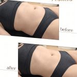 Lymphatic drainage Osteo Health
