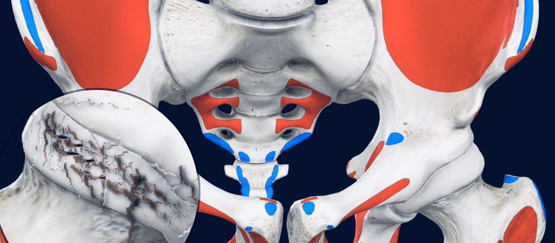 Article. Osteoarthrosis.