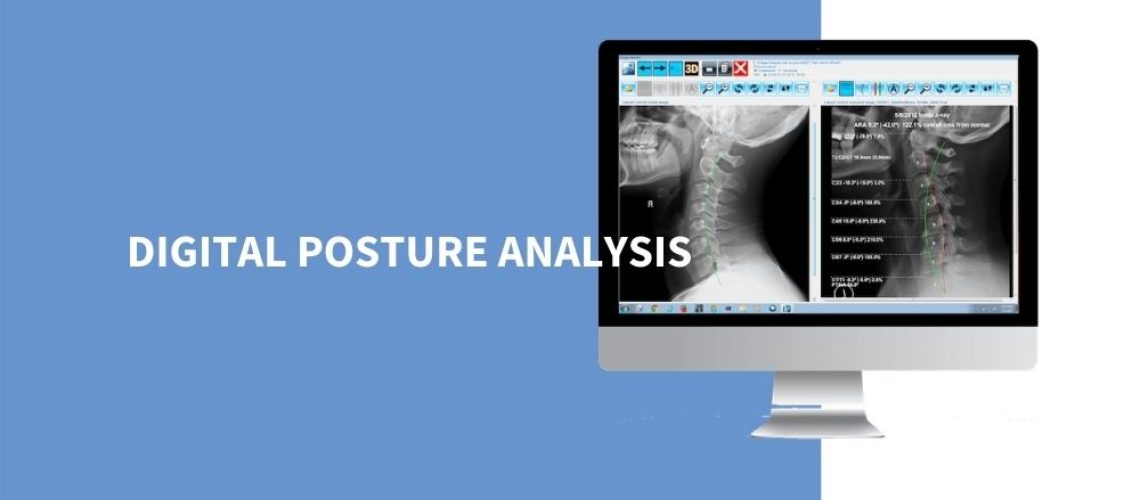 posture assessment