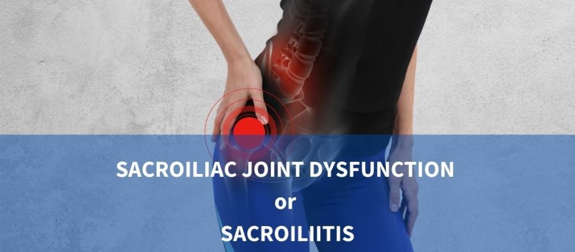 Sacroiliac joint dysfunction or sacroiliitis Symptoms, Causes